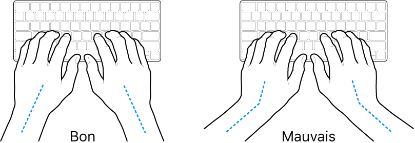 Mains placées sur un clavier, montrant le bon et le mauvais alignement des poignets et des mains.