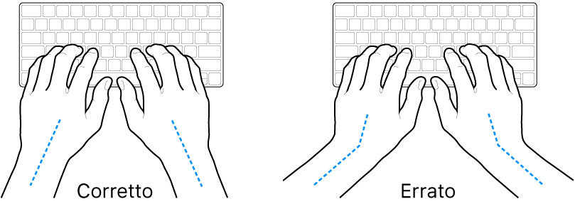 Mani posizionate su una tastiera che illustrano l'allineamento corretto ed errato di polso e mano.