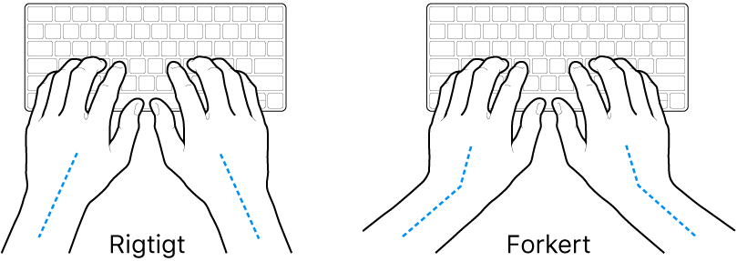 Hænder anbragt over et tastatur med rigtig og forkert position af håndled og hånd.