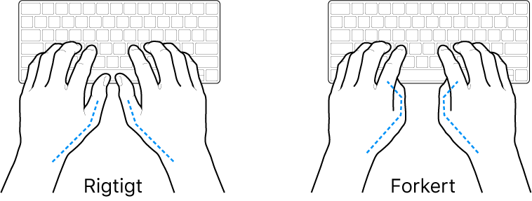 Hænder anbragt over et tastatur med rigtig og forkert position af tommelfingre.