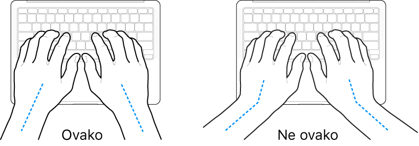 Ruke položene na tipkovnicu s prikazom pravilnog i nepravilnog položaja zapešća i ruku.