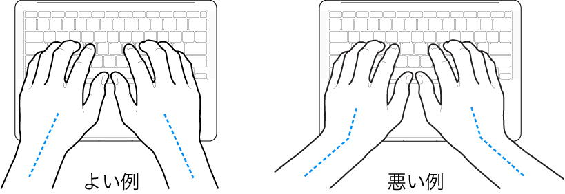 キーボードに置かれた手。手首と手の適切な位置関係と不適切な位置関係を示しています。