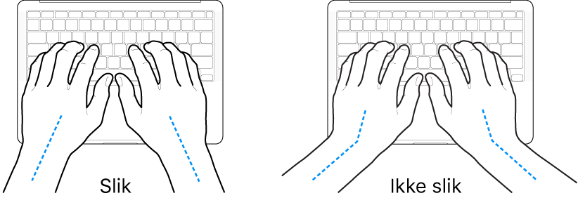 Hender plassert over et tastatur som viser riktig og feil stilling for håndledd og hender.