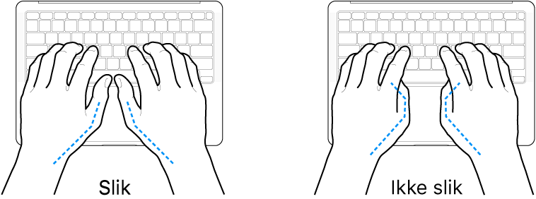 Hender plassert over et tastatur som viser riktig og feil tommelstilling.
