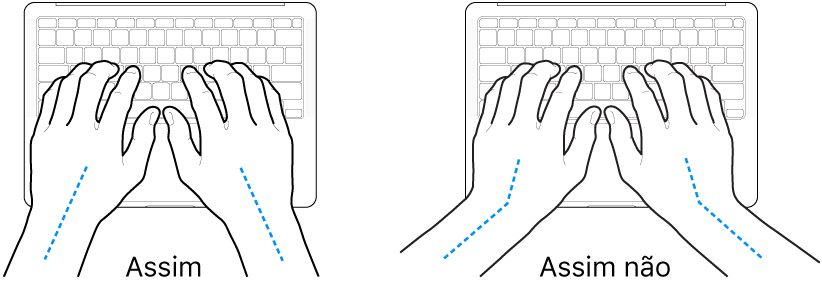 As mãos posicionadas sobre um teclado a mostrar alinhamentos corretos e incorretos das mãos e dos pulsos.