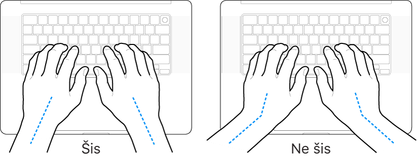 Rokas novietotas virs tastatūras, parādot pareizu un nepareizu plaukstas un rokas novietojumu.