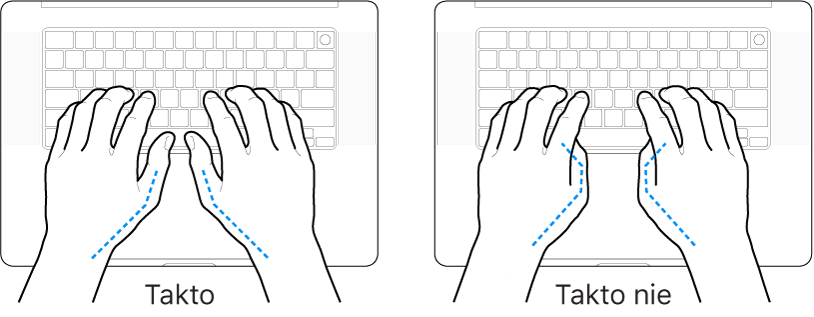 Ruky položené na klávesnici znázorňujúce správnu a nesprávnu polohu palcov.