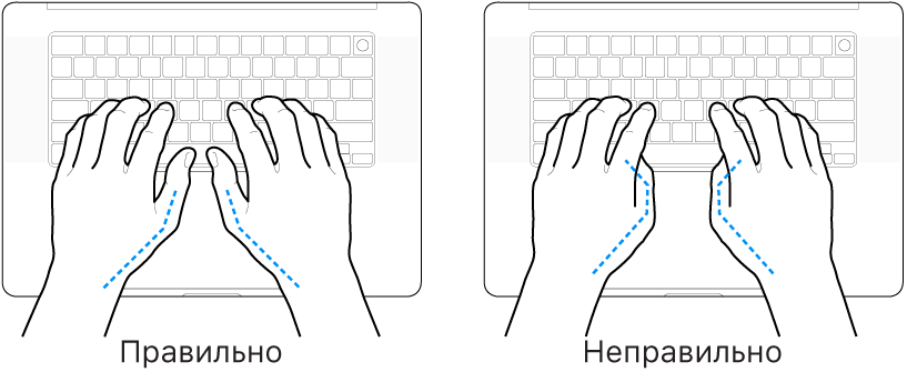 Руки розташовано над клавіатурою й показано правильне та неправильне положення великих пальців.