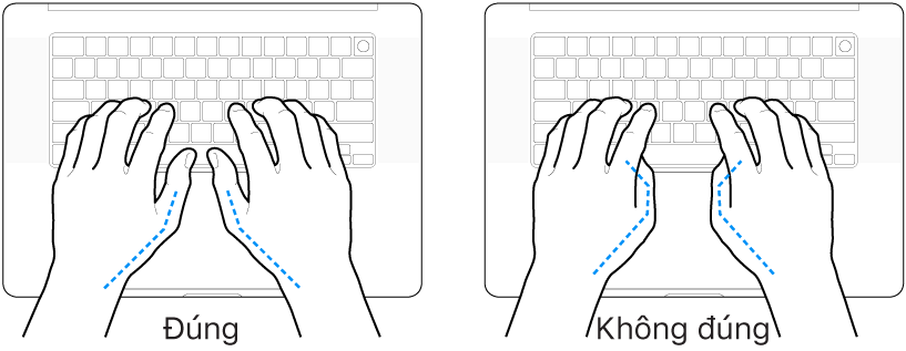 Các bàn tay đặt phía trên bàn phím, minh họa cách đặt ngón cái đúng và sai.