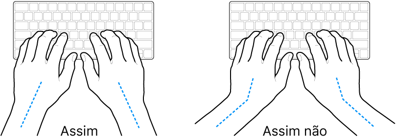 As mãos posicionadas sobre um teclado a mostrar alinhamentos corretos e incorretos das mãos e dos pulsos.