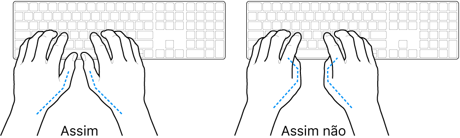 As mãos posicionadas sobre um teclado a mostrar a colocação correta e incorreta dos polegares.