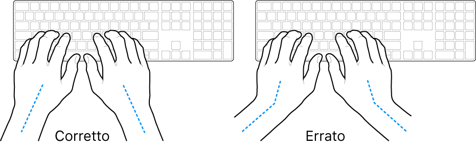 Mani posizionate su una tastiera che illustrano l'allineamento corretto ed errato di polso e mano.