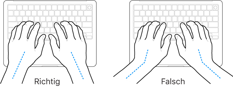 Tastatur und Hände in richtiger und falscher Haltung von Handgelenk und Händen