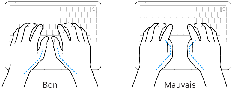 Mains placées sur un clavier, montrant la bonne et la mauvaise position des pouces.