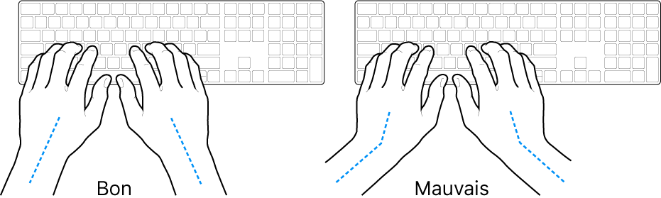 Mains placées sur un clavier, montrant le bon et le mauvais alignement des poignets et des mains.