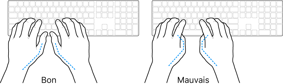 Mains placées sur un clavier, montrant la bonne et la mauvaise position des pouces.