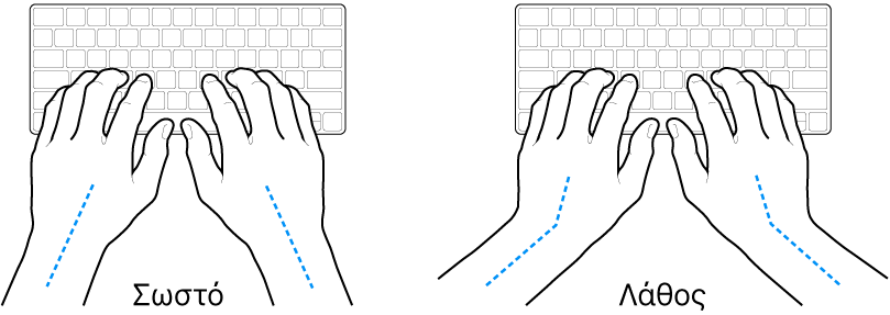 Χέρια τοποθετημένα επάνω σε ένα πληκτρολόγιο, που δείχνουν τη σωστή και τη λανθασμένη θέση των καρπών σε σχέση με τα χέρια.