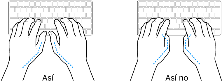 Manos posicionadas sobre un teclado, mostrando la alineación correcta e incorrecta de los pulgares.