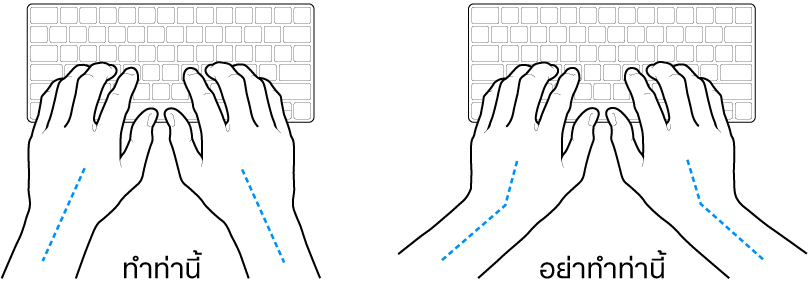 มือวางอยู่เหรือแป้นพิมพ์ แสดงตำแหน่งการวางข้อมือและแขนที่ถูกต้องและไม่ถูกต้อง