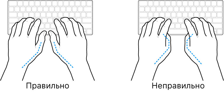 Руки розташовано над клавіатурою й показано правильне та неправильне положення великих пальців.