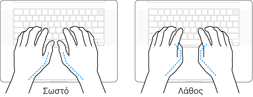 Χέρια τοποθετημένα επάνω σε ένα πληκτρολόγιο, που δείχνουν τη σωστή και τη λανθασμένη θέση των αντίχειρων.