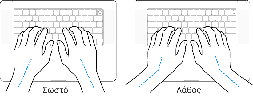 Χέρια τοποθετημένα επάνω σε ένα πληκτρολόγιο, που δείχνουν τη σωστή και τη λανθασμένη θέση των καρπών σε σχέση με τα χέρια.