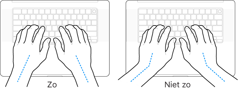 Handen boven een toetsenbord, waarbij de goede en verkeerde stand van de handen en polsen wordt aangegeven.
