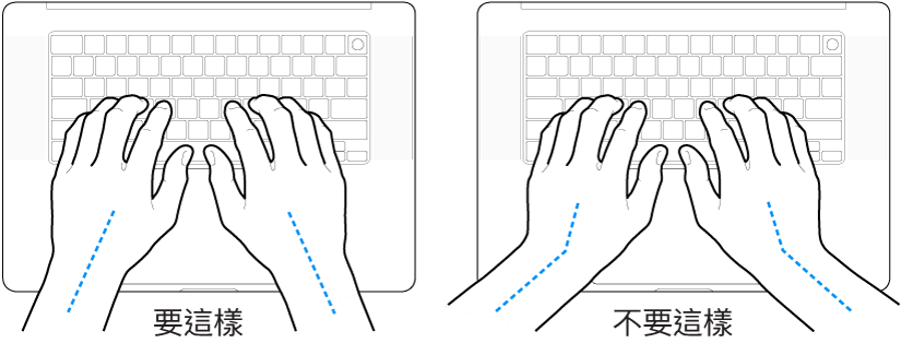 雙手置於鍵盤上，分別顯示正確與不正確的手肘與雙手對稱擺放位置。