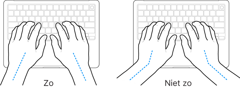 Handen boven een toetsenbord, waarbij de goede en verkeerde stand van de handen en polsen wordt aangegeven.
