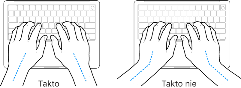 Ruky položené na klávesnici znázorňujúce správnu a nesprávnu polohu zápästia a ruky.