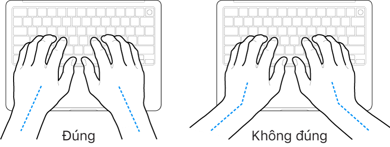 Các bàn tay đặt phía trên bàn phím, minh họa cách đặt cổ tay và bàn tay đúng và sai.
