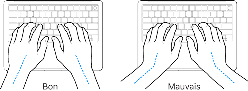 Mains placées sur un clavier, montrant le bon et le mauvais alignement des poignets et des mains.