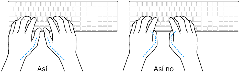 Manos posicionadas sobre un teclado, mostrando la alineación correcta e incorrecta de los pulgares.