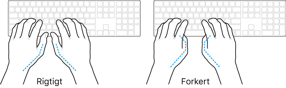 Hænder anbragt over et tastatur med rigtig og forkert position af tommelfingre.