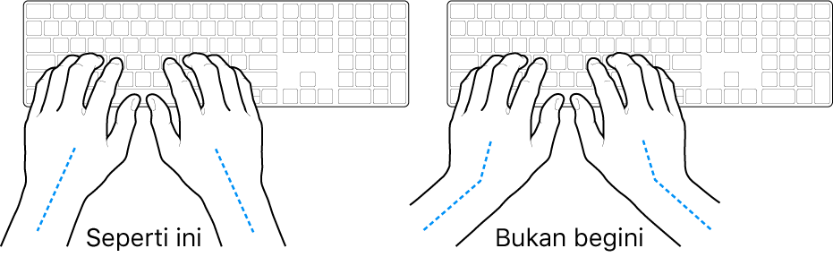 Tangan diposisikan di atas papan ketik, menampilkan penyejajaran pergelangan tangan dan tangan yang benar dan salah.