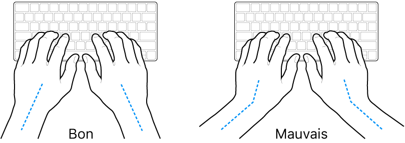 Mains placées sur un clavier, montrant le bon et le mauvais alignement des poignets et des mains.