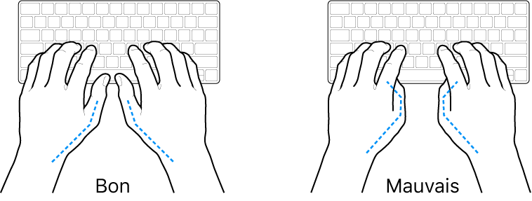 Mains placées sur un clavier, montrant la bonne et la mauvaise position des pouces.