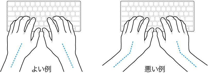 キーボードに置かれた手。手首と手の適切な位置関係と不適切な位置関係を示しています。