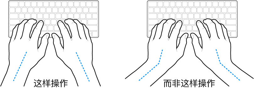 手掌放在键盘上方，显示手腕和手掌的正确对齐位置和错误对齐位置。