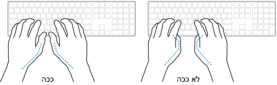 ידיים מעל מקלדת, להדגמת מנח נכון ומנח שגוי של האגודלים.