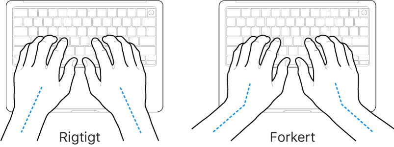 Hænder anbragt over et tastatur med rigtig og forkert position af håndled og hånd.