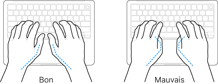 Mains placées sur un clavier, montrant la bonne et la mauvaise position des pouces.