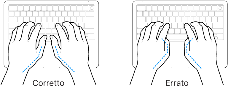 Mani posizionate su una tastiera che illustrano il posizionamento corretto ed errato dei pollici.