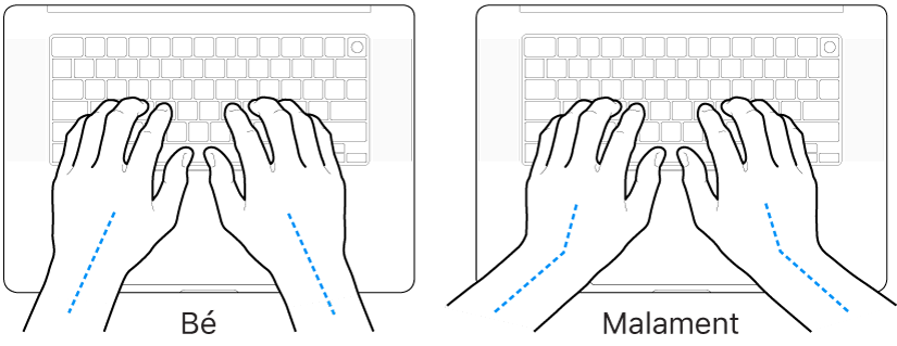 Unes mans posades sobre un teclat mostrant l’alineació correcta i incorrecta del canell i la mà.