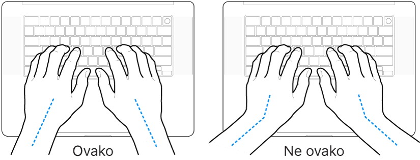 Ruke položene na tipkovnicu s prikazom pravilnog i nepravilnog položaja zapešća i ruku.
