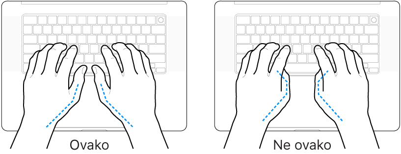 Ruke položene na tipkovnicu s prikazom pravilnog i nepravilnog položaja palaca.