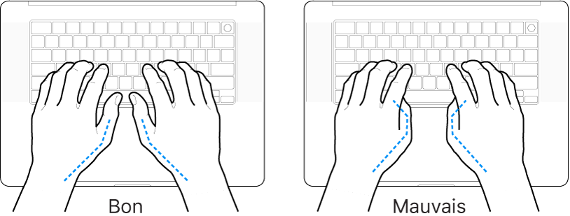 Mains placées sur un clavier, montrant la bonne et la mauvaise position des pouces.