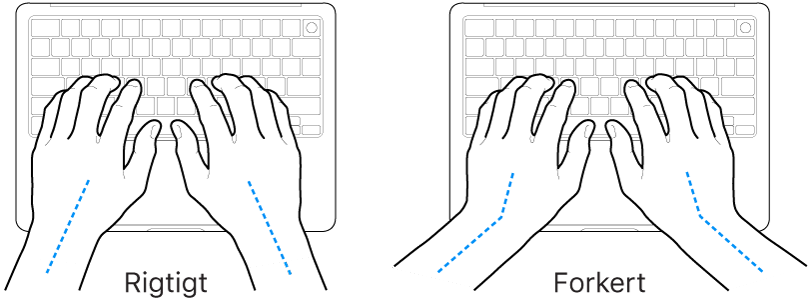 Hænder anbragt over et tastatur med rigtig og forkert position af håndled og hånd.