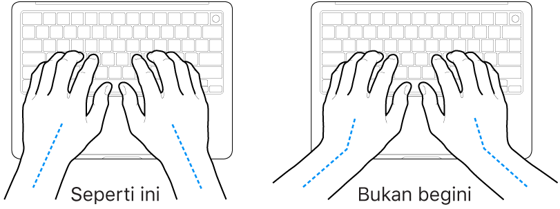 Tangan diposisikan di atas papan ketik, menampilkan penyejajaran pergelangan tangan dan tangan yang benar dan salah.