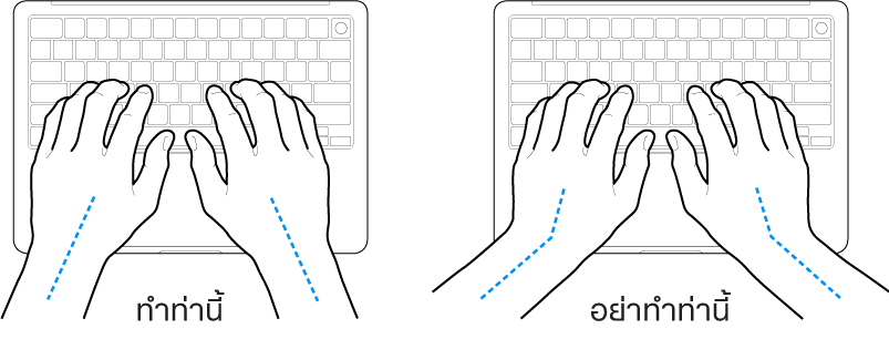 มือวางอยู่เหรือแป้นพิมพ์ แสดงตำแหน่งการวางข้อมือและแขนที่ถูกต้องและไม่ถูกต้อง